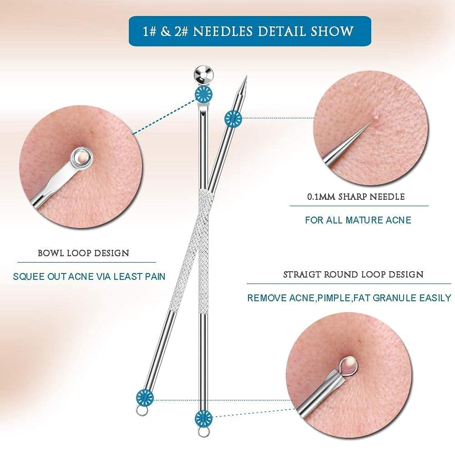 Blackhead Remover, 4-in-1 Stainless Steel Pimple Extractor Tool (1 Pc) - view 4
