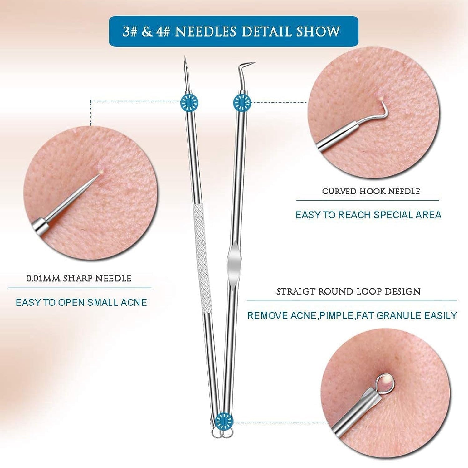 Blackhead Remover, 4-in-1 Stainless Steel Pimple Extractor Tool (1 Pc) - view 6